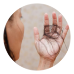 Hair Fall