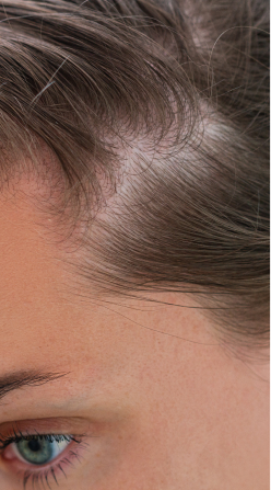 before_image